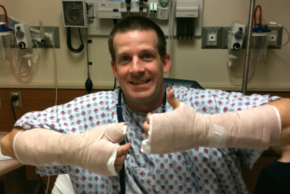 broken hands broken hands